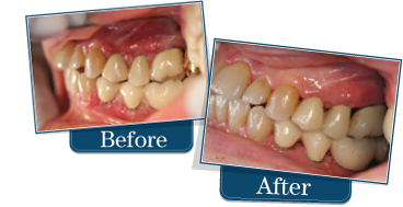 Laser Gum Surgeon, Periodontist Dennis E. Winson, DDS